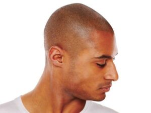 Landmark Hair Loss Clinic