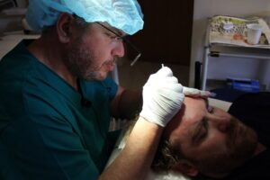 Hair loss solution: Hair Transplants, Will it work for me?